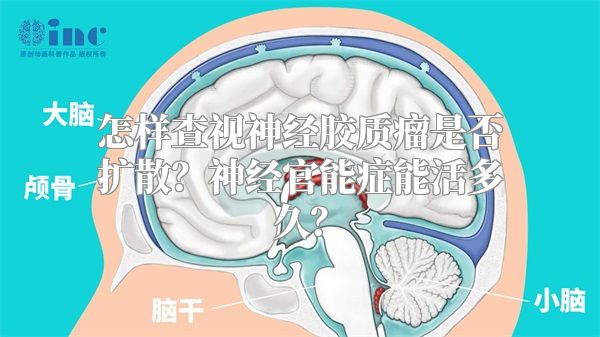 怎样查视神经胶质瘤是否扩散？神经官能症能活多久？