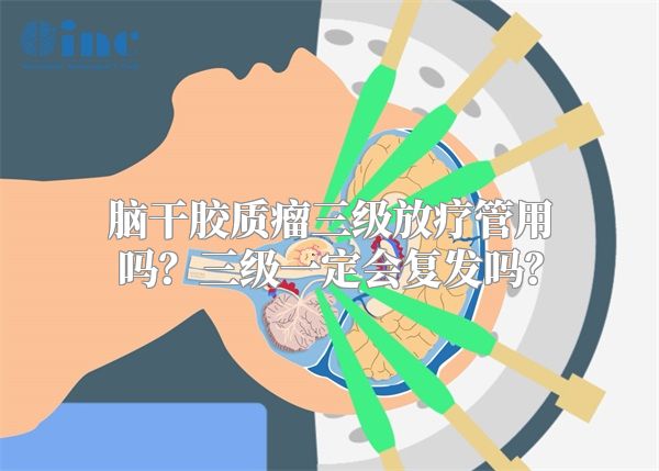 脑干胶质瘤三级放疗管用吗？三级一定会复发吗？