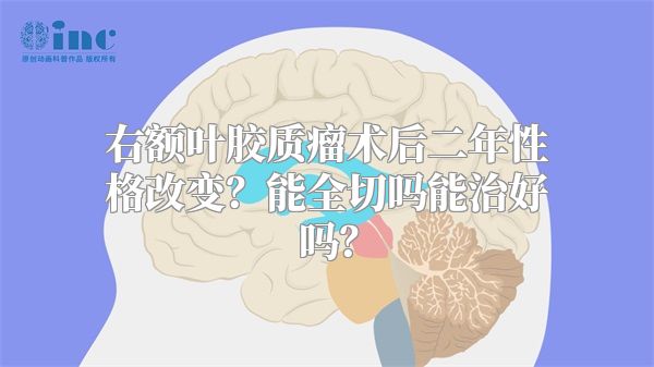 右额叶胶质瘤术后二年性格改变？能全切吗能治好吗？