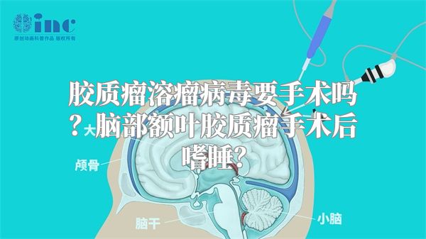 胶质瘤溶瘤病毒要手术吗？脑部额叶胶质瘤手术后嗜睡？