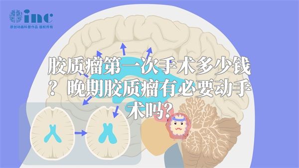 胶质瘤第一次手术多少钱？晚期胶质瘤有必要动手术吗？