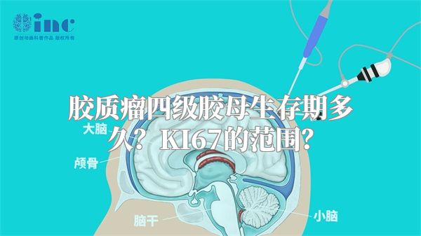 胶质瘤四级胶母生存期多久？KI67的范围？