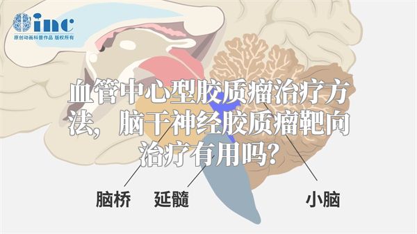 血管中心型胶质瘤治疗方法，脑干神经胶质瘤靶向治疗有用吗？