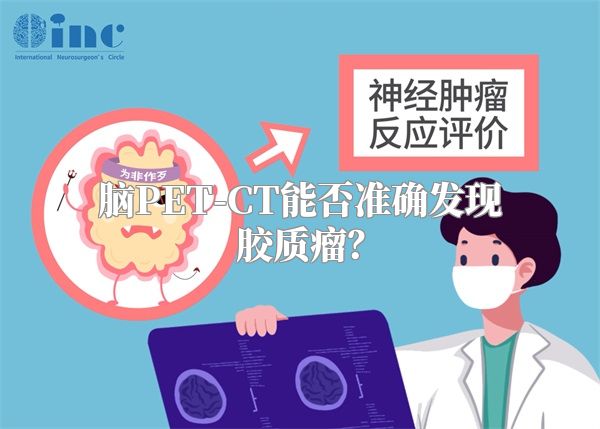 脑PET-CT能否准确发现胶质瘤？