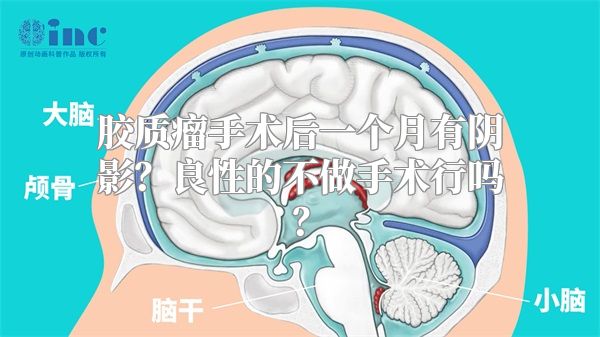 胶质瘤手术后一个月有阴影？良性的不做手术行吗？