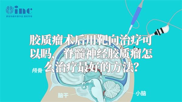 胶质瘤术后用靶向治疗可以吗，脊髓神经胶质瘤怎么治疗最好的方法？