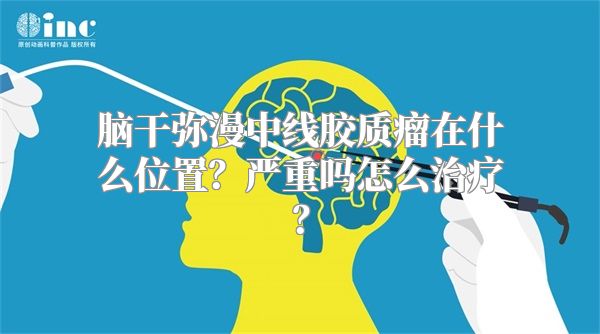 脑干弥漫中线胶质瘤在什么位置？严重吗怎么治疗？