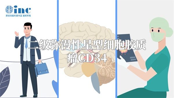 二级弥漫性星型细胞胶质瘤CD34