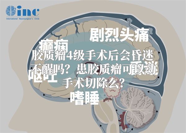 胶质瘤4级手术后会昏迷不醒吗？患胶质瘤可以动手术切除么？