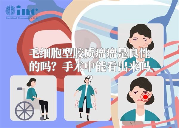 毛细胞型胶质瘤瘤是良性的吗？手术中能看出来吗？