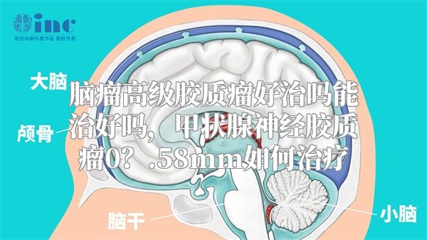 脑瘤高级胶质瘤好治吗能治好吗，甲状腺神经胶质瘤0？.58mm如何治疗