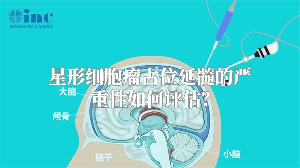 星形细胞瘤占位延髓的严重性如何评估？