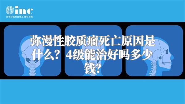 弥漫性胶质瘤死亡原因是什么？4级能治好吗多少钱？