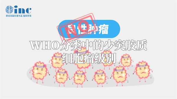 WHO分类中的少突胶质细胞瘤级别