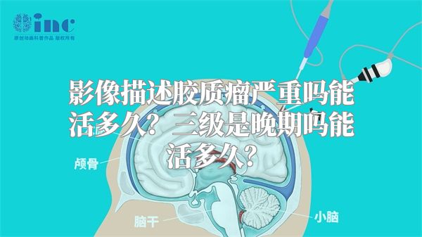 影像描述胶质瘤严重吗能活多久？三级是晚期吗能活多久？