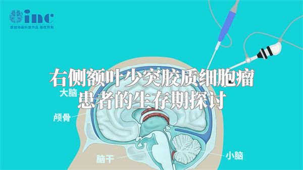 右侧额叶少突胶质细胞瘤患者的生存期探讨