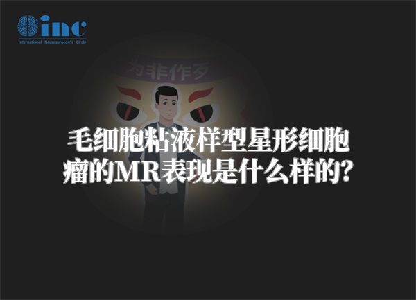 毛细胞粘液样型星形细胞瘤的MR表现是什么样的？