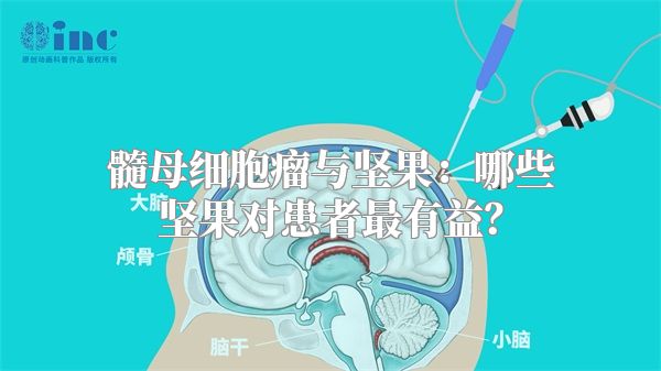 髓母细胞瘤与坚果：哪些坚果对患者最有益？