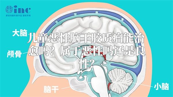 儿童恶性脑干胶质瘤能治愈吗？属于恶性吗还是良性？