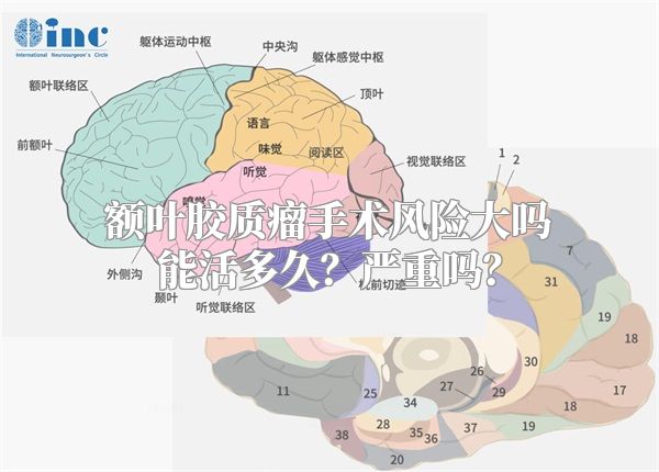 额叶胶质瘤手术风险大吗能活多久？严重吗？