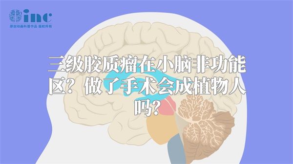 三级胶质瘤在小脑非功能区？做了手术会成植物人吗？