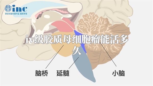 iv级胶质母细胞瘤能活多久