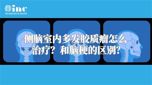 侧脑室内多发胶质瘤怎么治疗？和脑梗的区别？