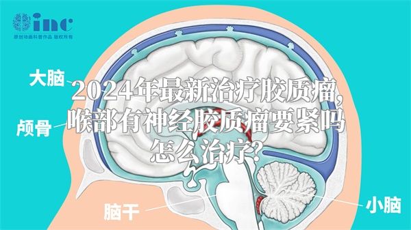 2024年最新治疗胶质瘤，喉部有神经胶质瘤要紧吗怎么治疗？