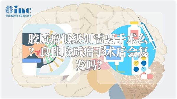 胶质瘤低级别需要手术么？良性胶质瘤手术后会复发吗？