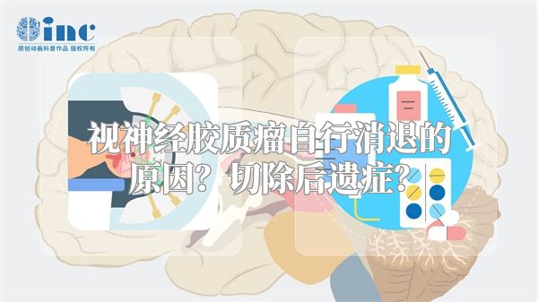 视神经胶质瘤自行消退的原因？切除后遗症？