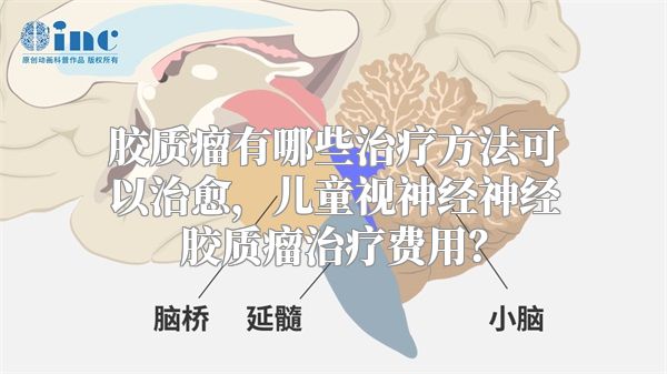 胶质瘤有哪些治疗方法可以治愈，儿童视神经神经胶质瘤治疗费用？