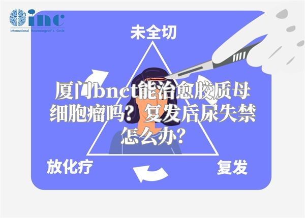 厦门bnct能治愈胶质母细胞瘤吗？复发后尿失禁怎么办？