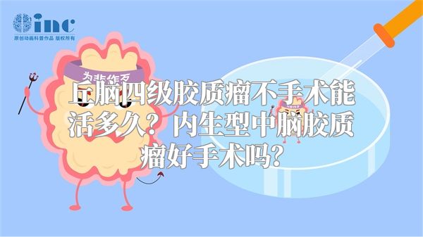 丘脑四级胶质瘤不手术能活多久？内生型中脑胶质瘤好手术吗？