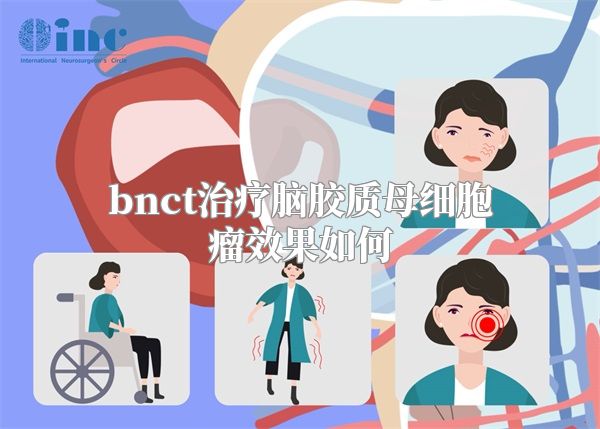 bnct治疗脑胶质母细胞瘤效果如何