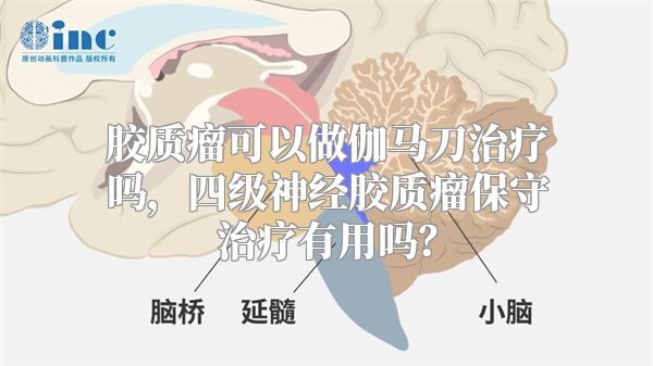 胶质瘤可以做伽马刀治疗吗，四级神经胶质瘤保守治疗有用吗？