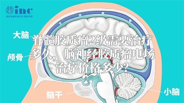 脊髓胶质瘤2级需要治疗多久，脑神经胶质瘤电场治疗价格多少？