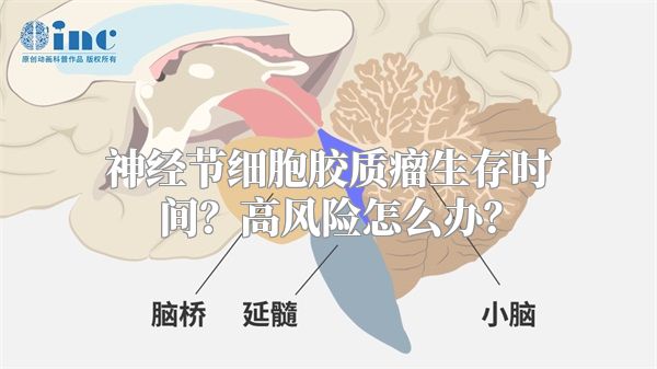 神经节细胞胶质瘤生存时间？高风险怎么办？