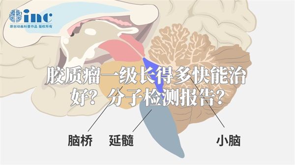 胶质瘤一级长得多快能治好？分子检测报告？