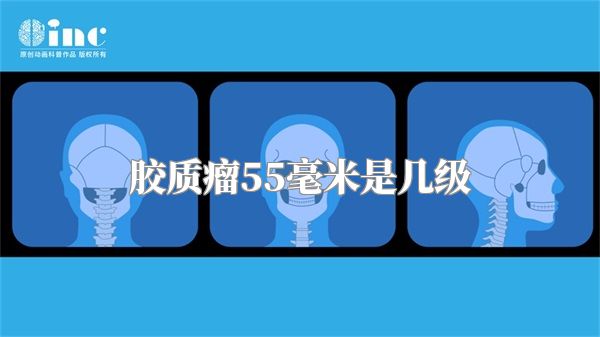 胶质瘤55毫米是几级