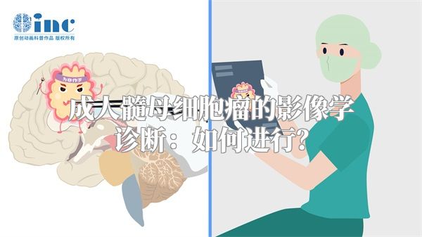 成人髓母细胞瘤的影像学诊断：如何进行？