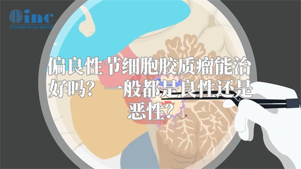 偏良性节细胞胶质瘤能治好吗？一般都是良性还是恶性？