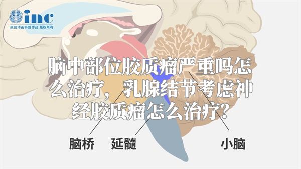 脑中部位胶质瘤严重吗怎么治疗，乳腺结节考虑神经胶质瘤怎么治疗？