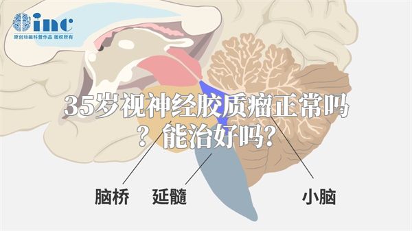 35岁视神经胶质瘤正常吗？能治好吗？