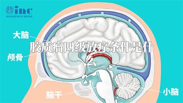 胶质瘤四级放疗条件是什么