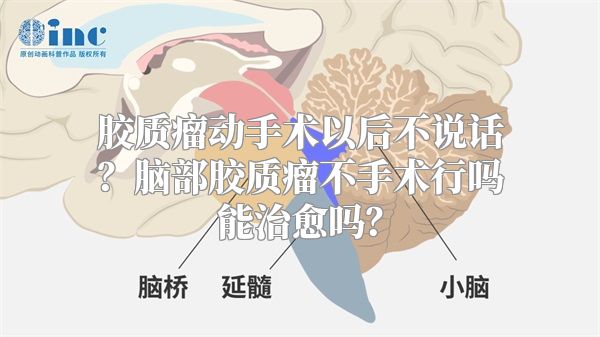 胶质瘤动手术以后不说话？脑部胶质瘤不手术行吗能治愈吗？