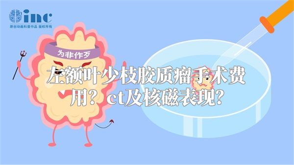 左额叶少枝胶质瘤手术费用？ct及核磁表现？