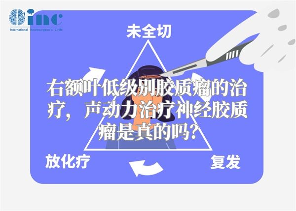 右额叶低级别胶质瘤的治疗，声动力治疗神经胶质瘤是真的吗？