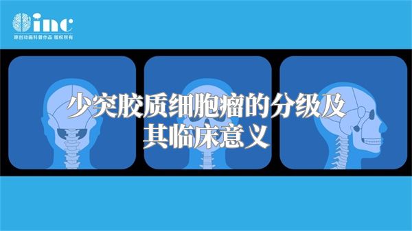 少突胶质细胞瘤的分级及其临床意义