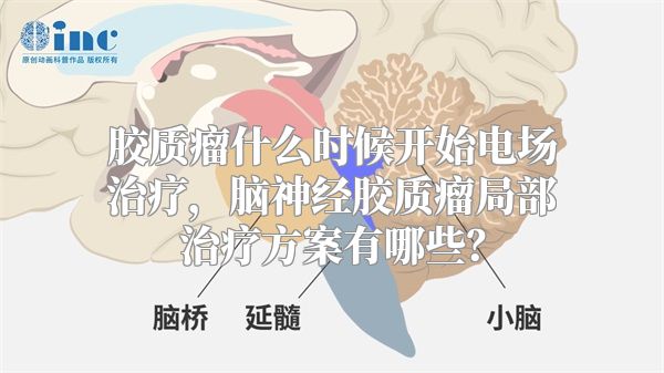 胶质瘤什么时候开始电场治疗，脑神经胶质瘤局部治疗方案有哪些？