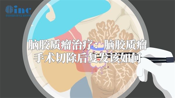 脑胶质瘤治疗：脑胶质瘤手术切除后复发该如何